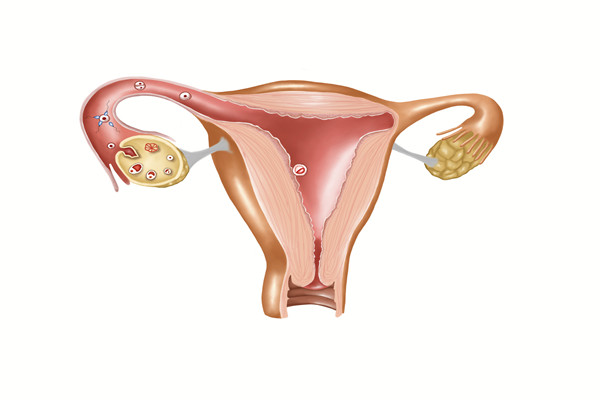 卵巢早衰有啥症状？怎么预防？