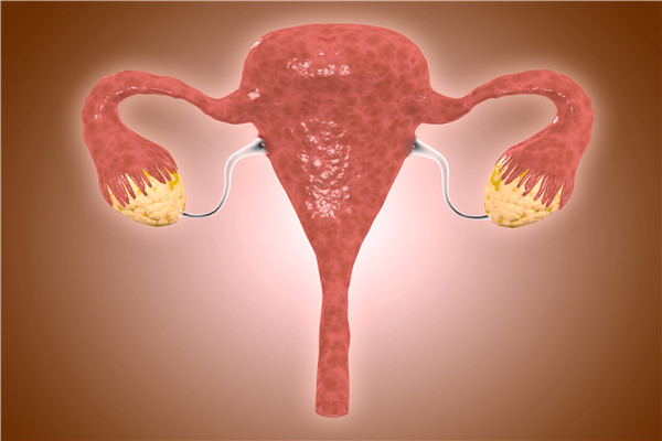 多囊是怎么回事？怎么预防卵巢多囊？
