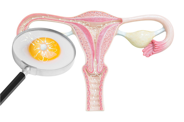 卵巢多囊的表现有哪些？严重吗？